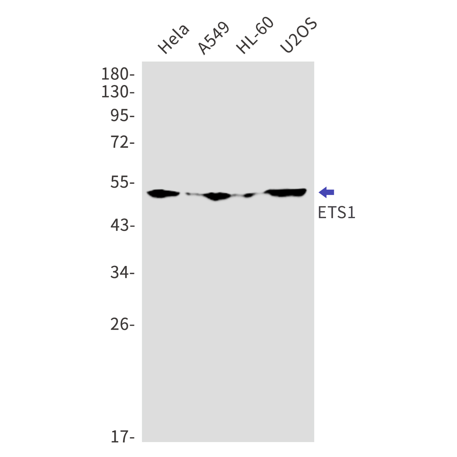 ETS1 Rabbit mAb