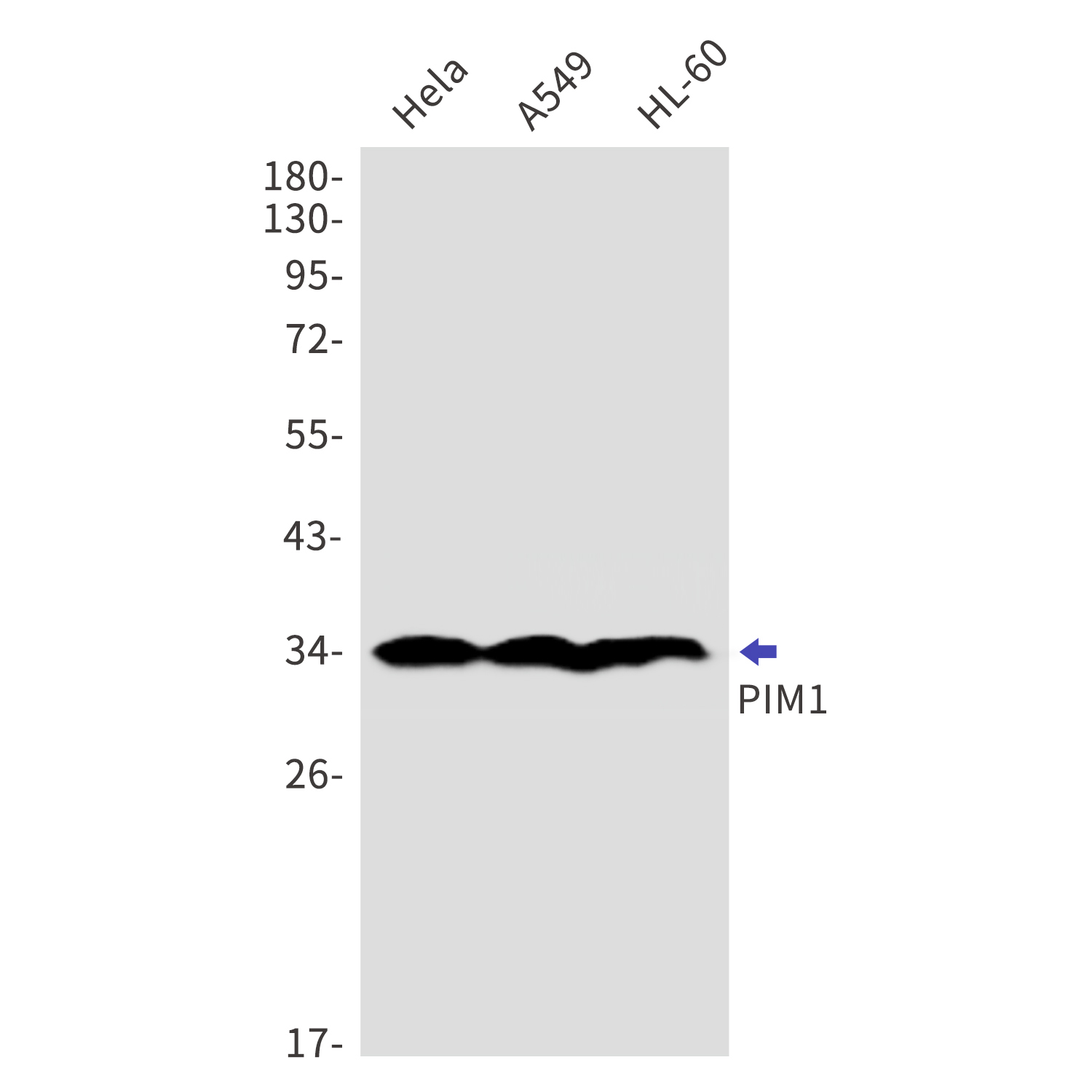 PIM1 Rabbit mAb