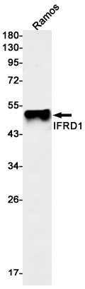 IFRD1 Rabbit mAb