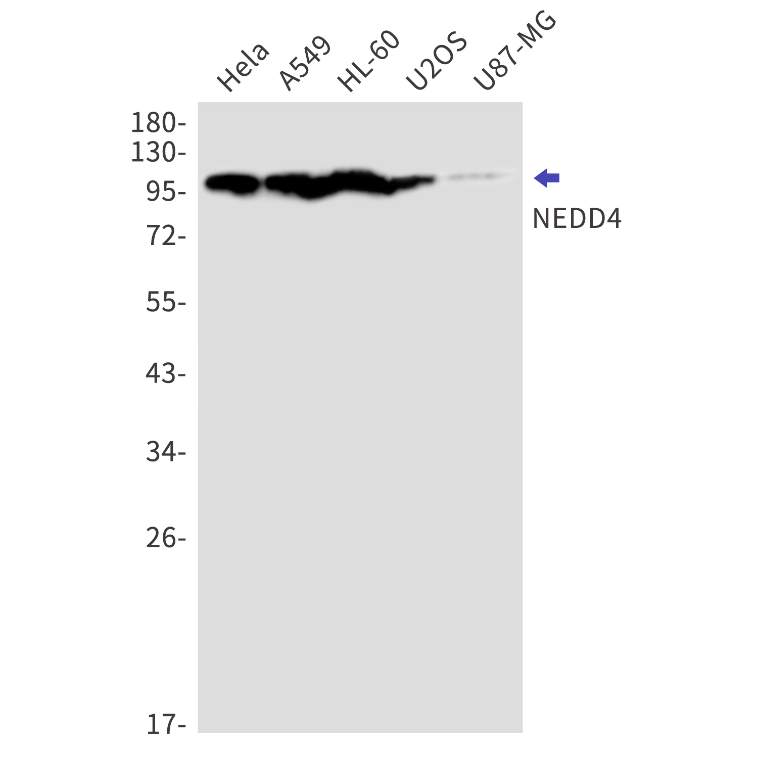 NEDD4 Rabbit mAb