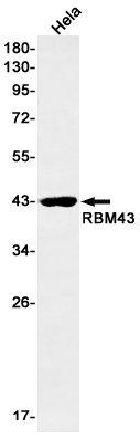 RBM43 Rabbit mAb