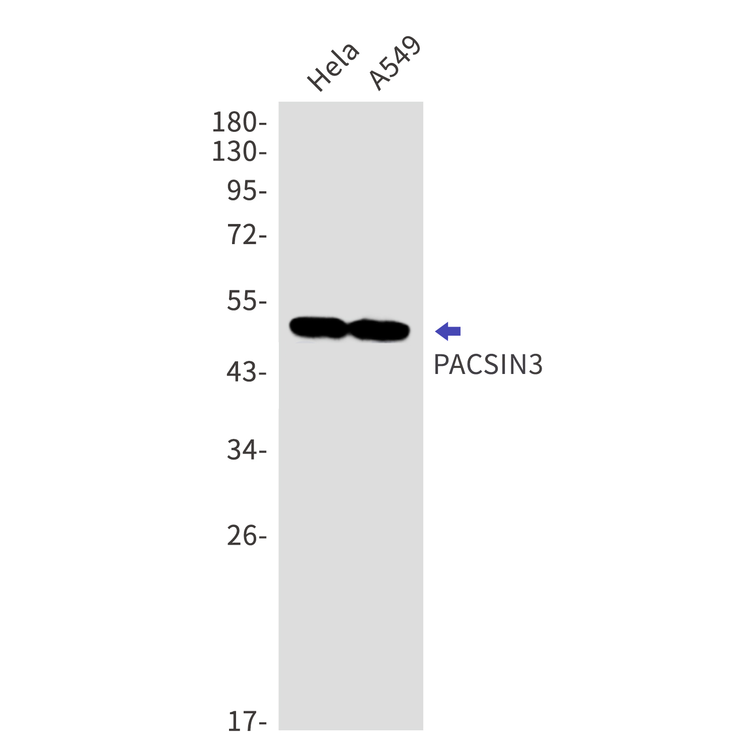 PACSIN3 Rabbit mAb