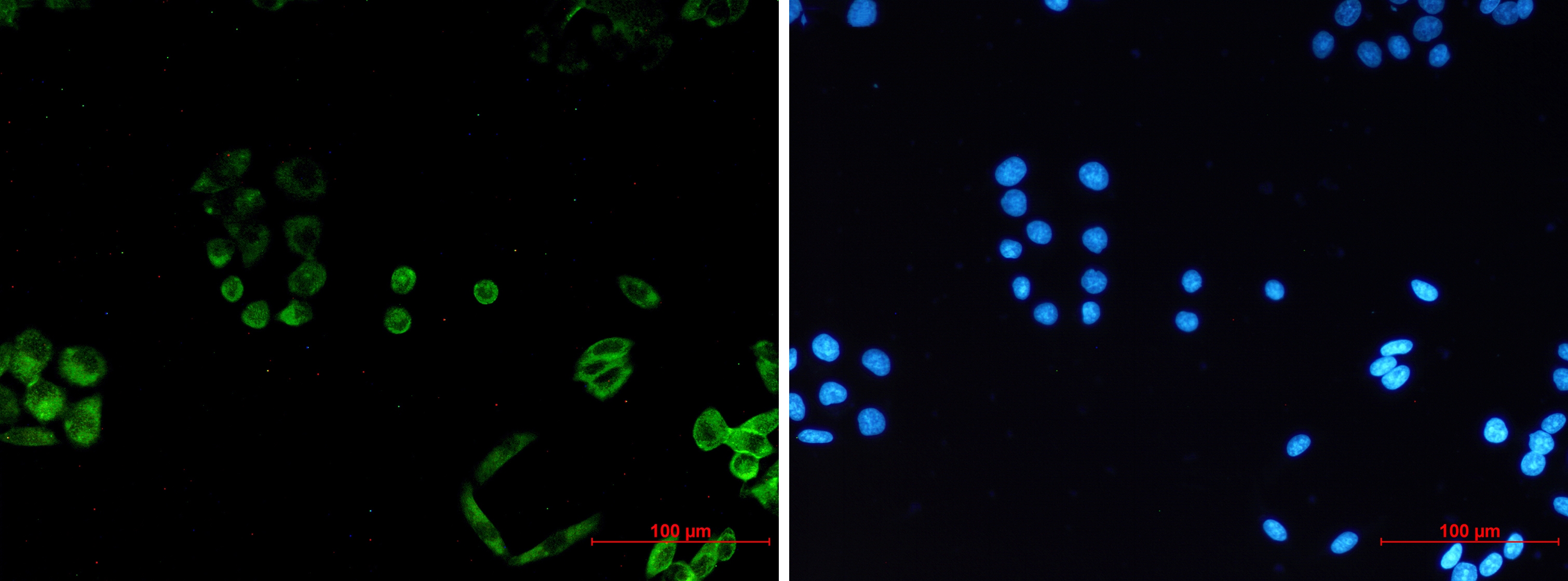 PACSIN3 Rabbit mAb