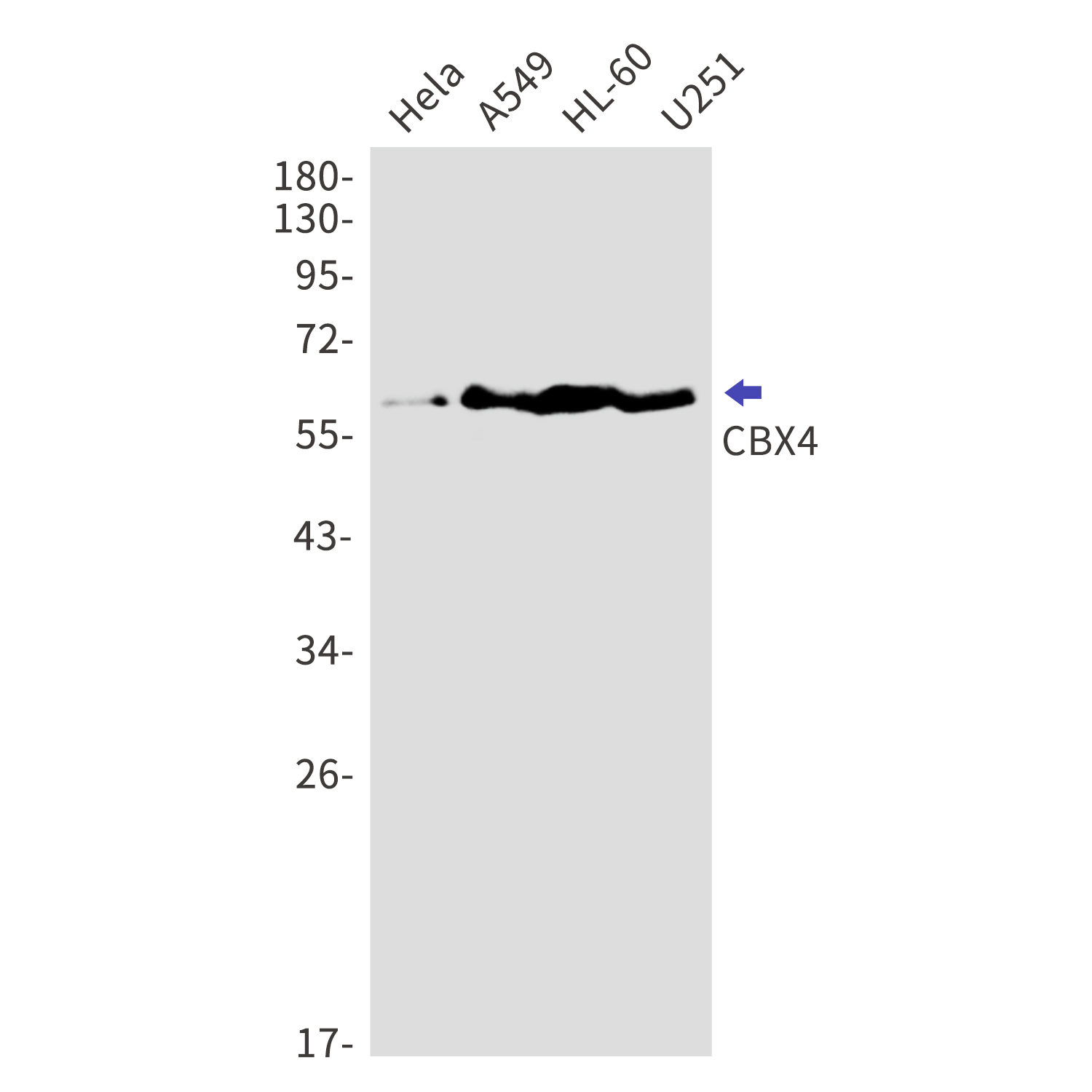 CBX4 Rabbit mAb