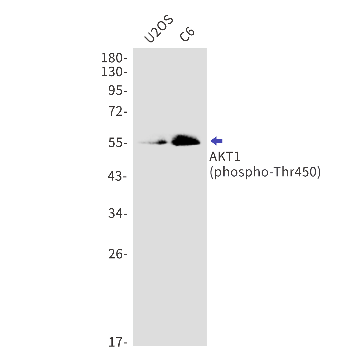 Phospho-AKT1 (Thr450) Rabbit mAb