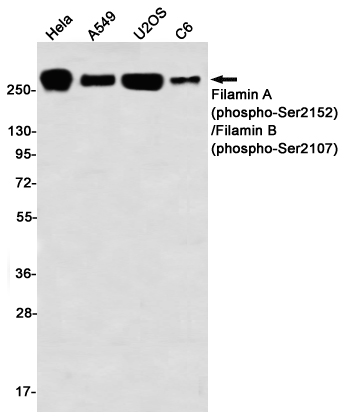 Phospho-Filamin A/B (Ser2152/Ser2107) Rabbit mAb