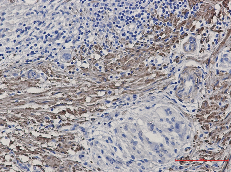 Phospho-Filamin A/B (Ser2152/Ser2107) Rabbit mAb