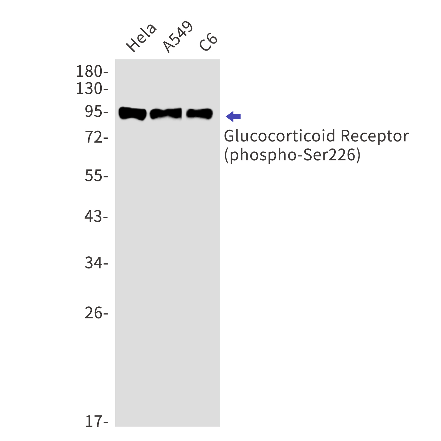 Phospho-Glucocorticoid Receptor (Ser226) Rabbit mAb