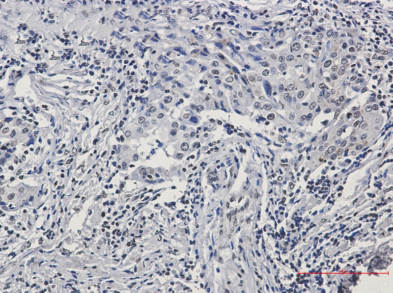 Phospho-Histone H3 (Ser10/Thr11) Rabbit mAb