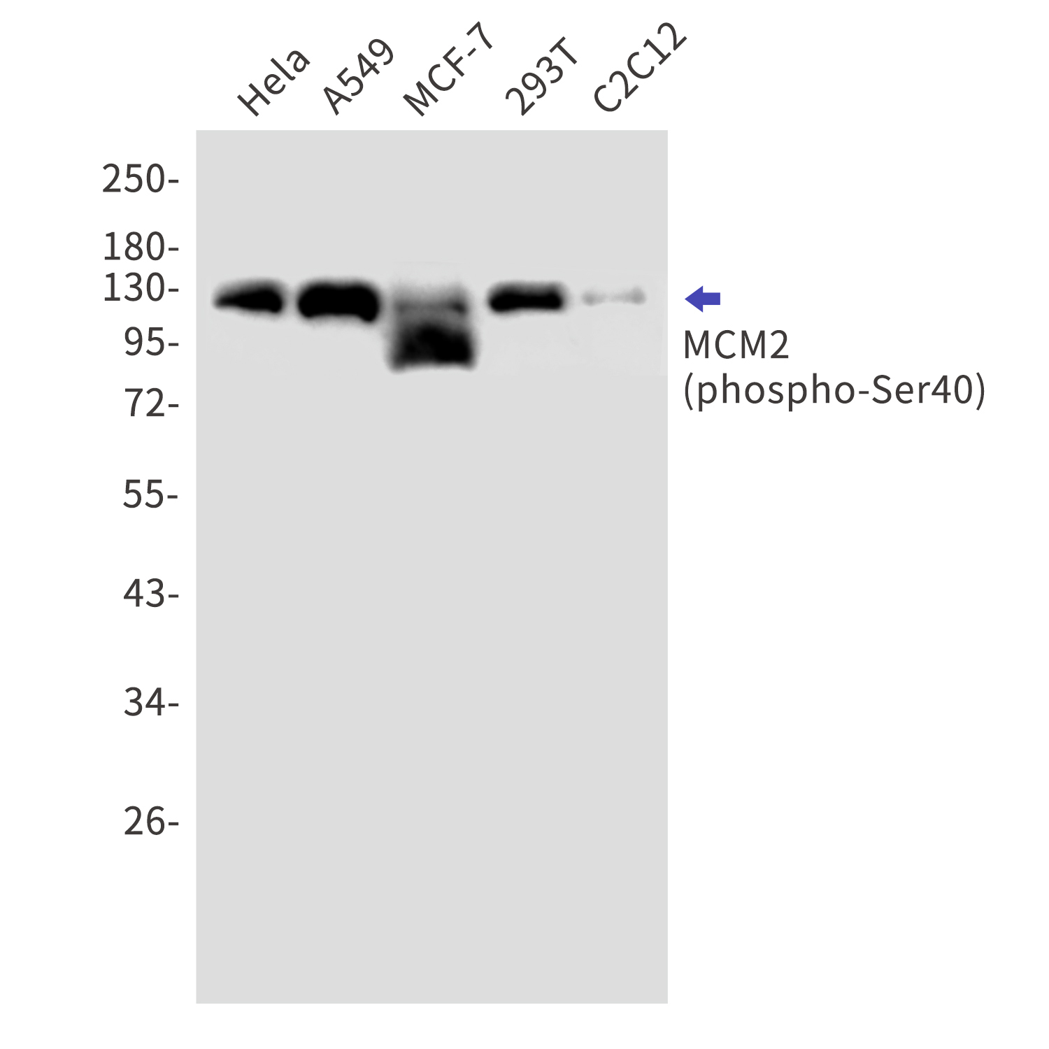 Phospho-MCM2 (Ser40) Rabbit mAb