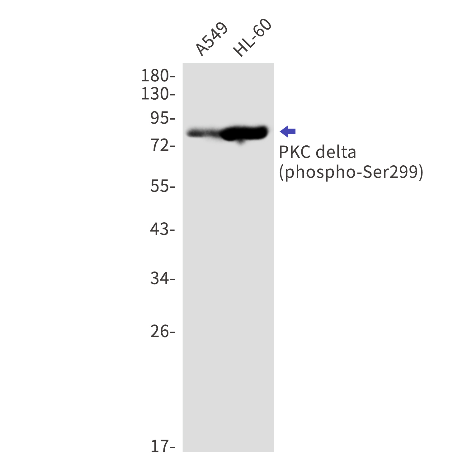 Phospho-PKC delta (Ser299) Rabbit mAb