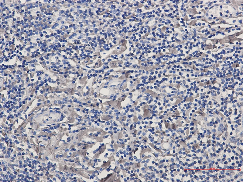 Phospho-PKC delta (Ser299) Rabbit mAb