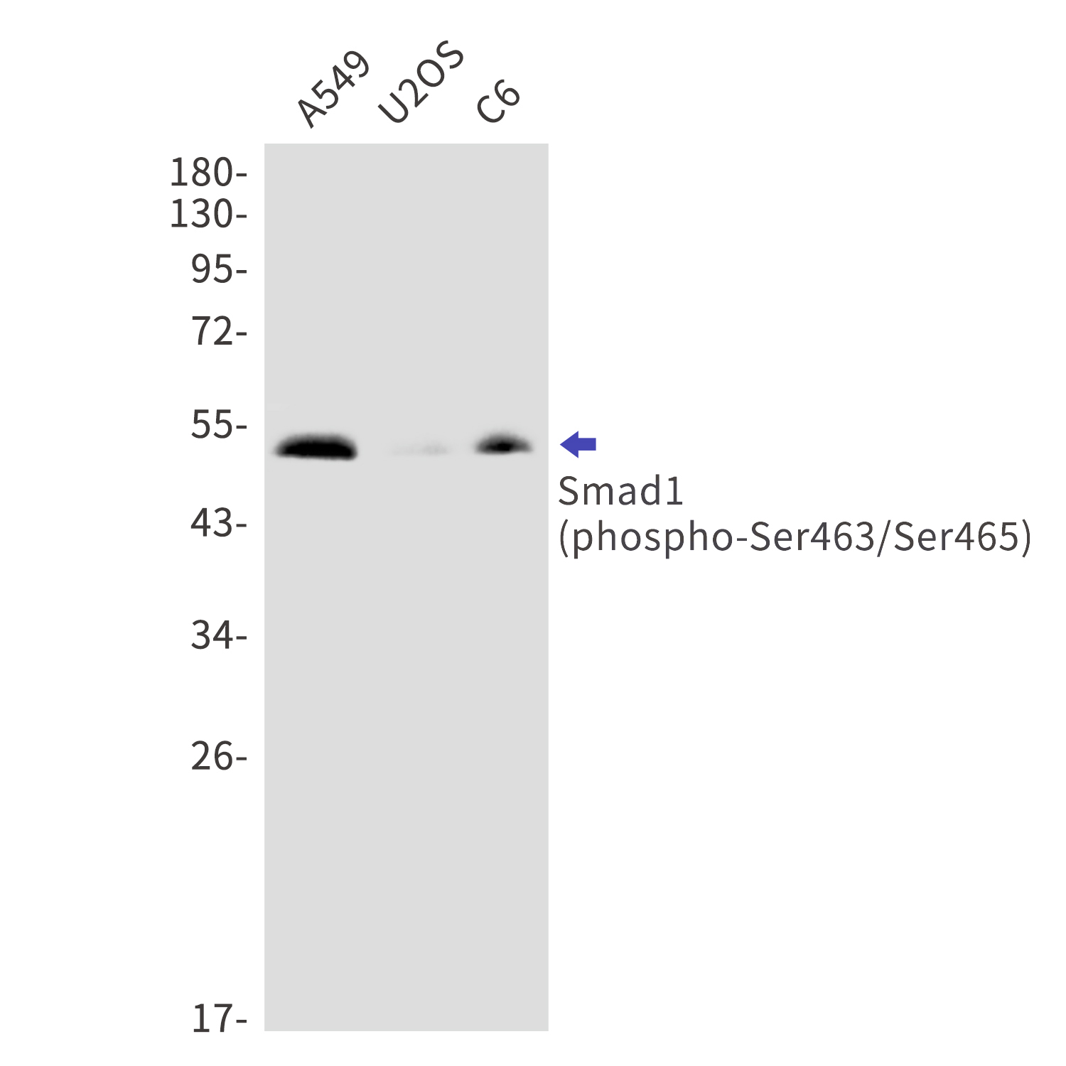 Phospho-Smad1 (Ser463/Ser465) Rabbit mAb