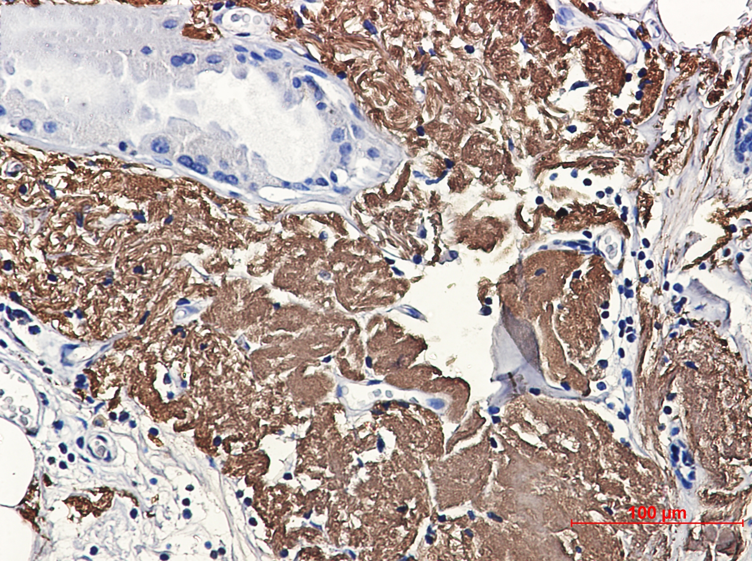 Aconitase 2 Rabbit mAb