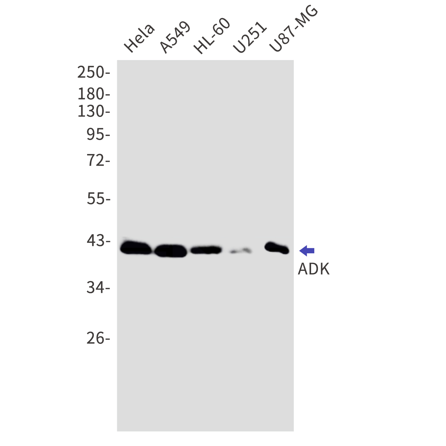 ADK Rabbit mAb