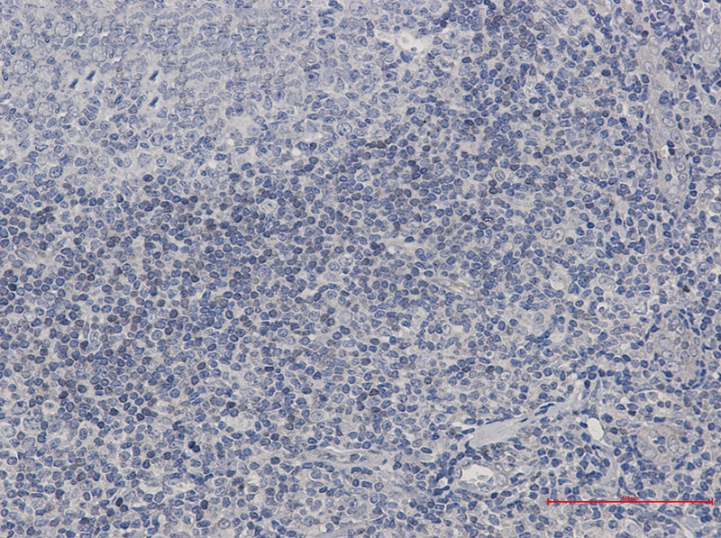 ADK Rabbit mAb