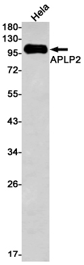 APLP2 Rabbit mAb