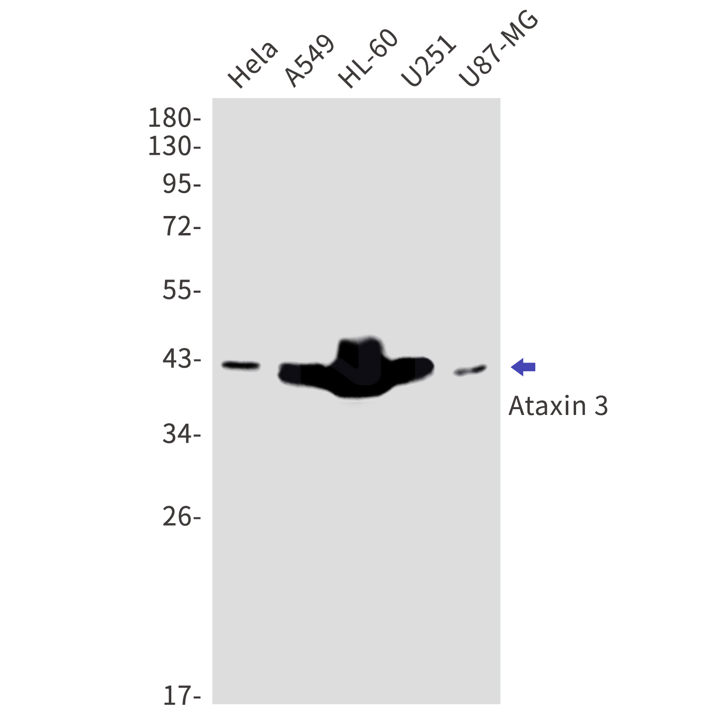 Ataxin 3 Rabbit mAb