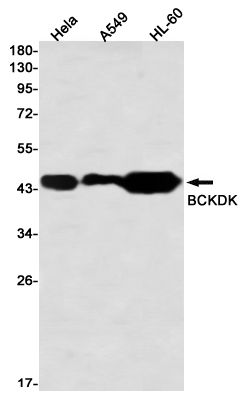 BCKDK Rabbit mAb