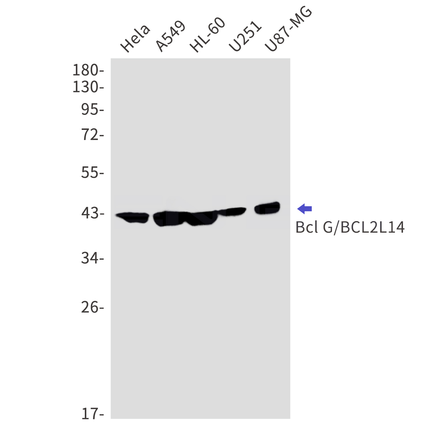 Bcl2 L14 Rabbit mAb