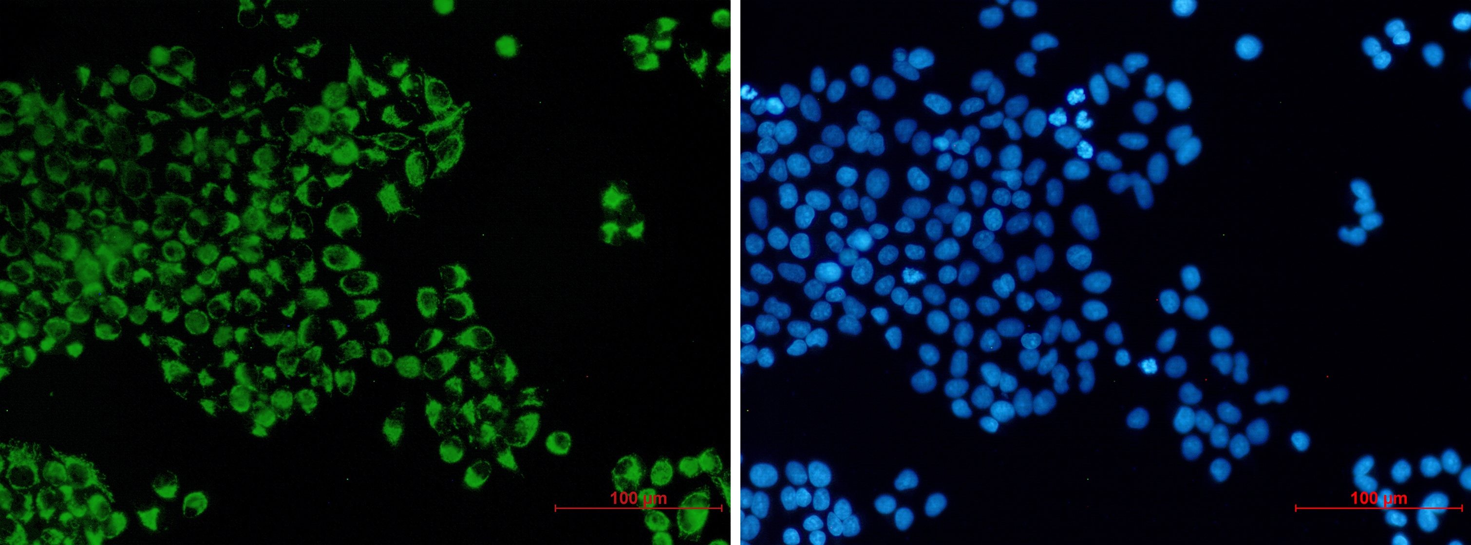 Bcl2 L14 Rabbit mAb