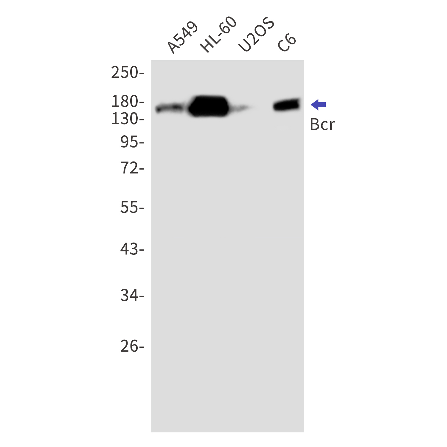 Bcr Rabbit mAb