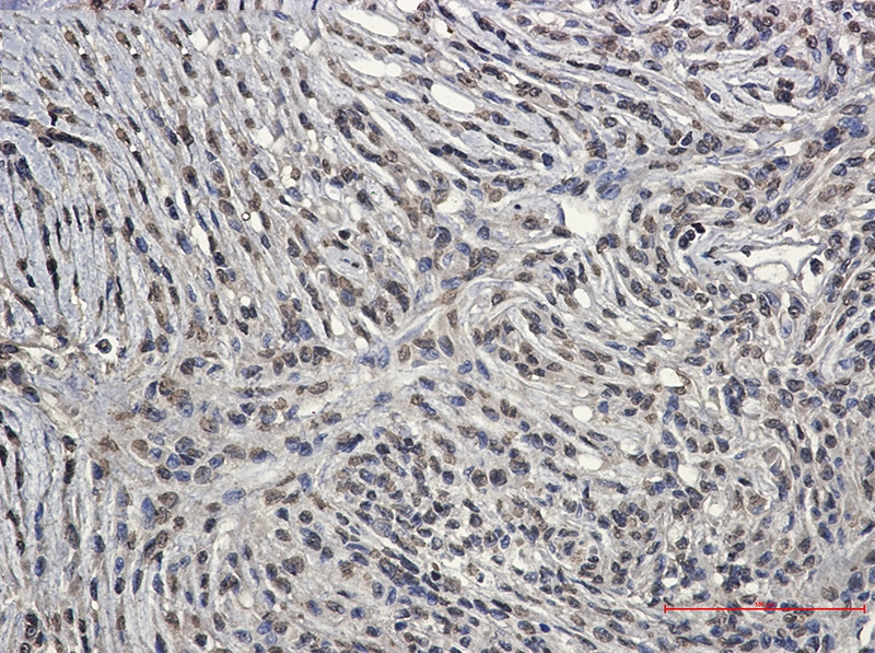 Bcr Rabbit mAb