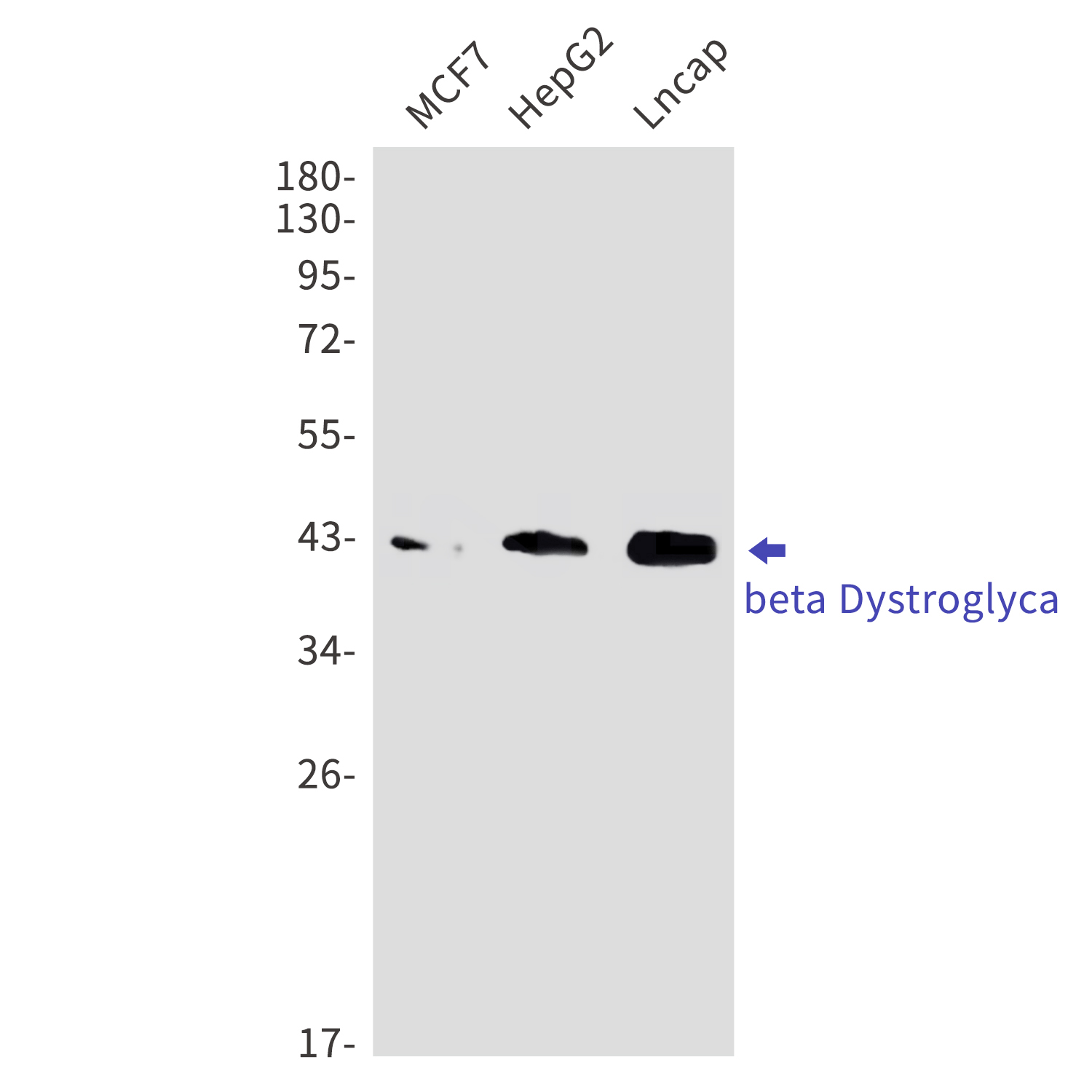 beta Dystroglycan Rabbit mAb