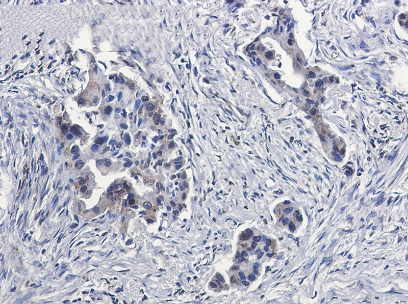 BUBR1 Rabbit mAb