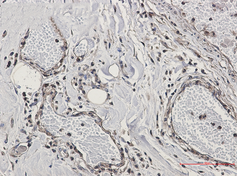 CAB39 Rabbit mAb