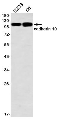 Cadherin 10 Rabbit mAb