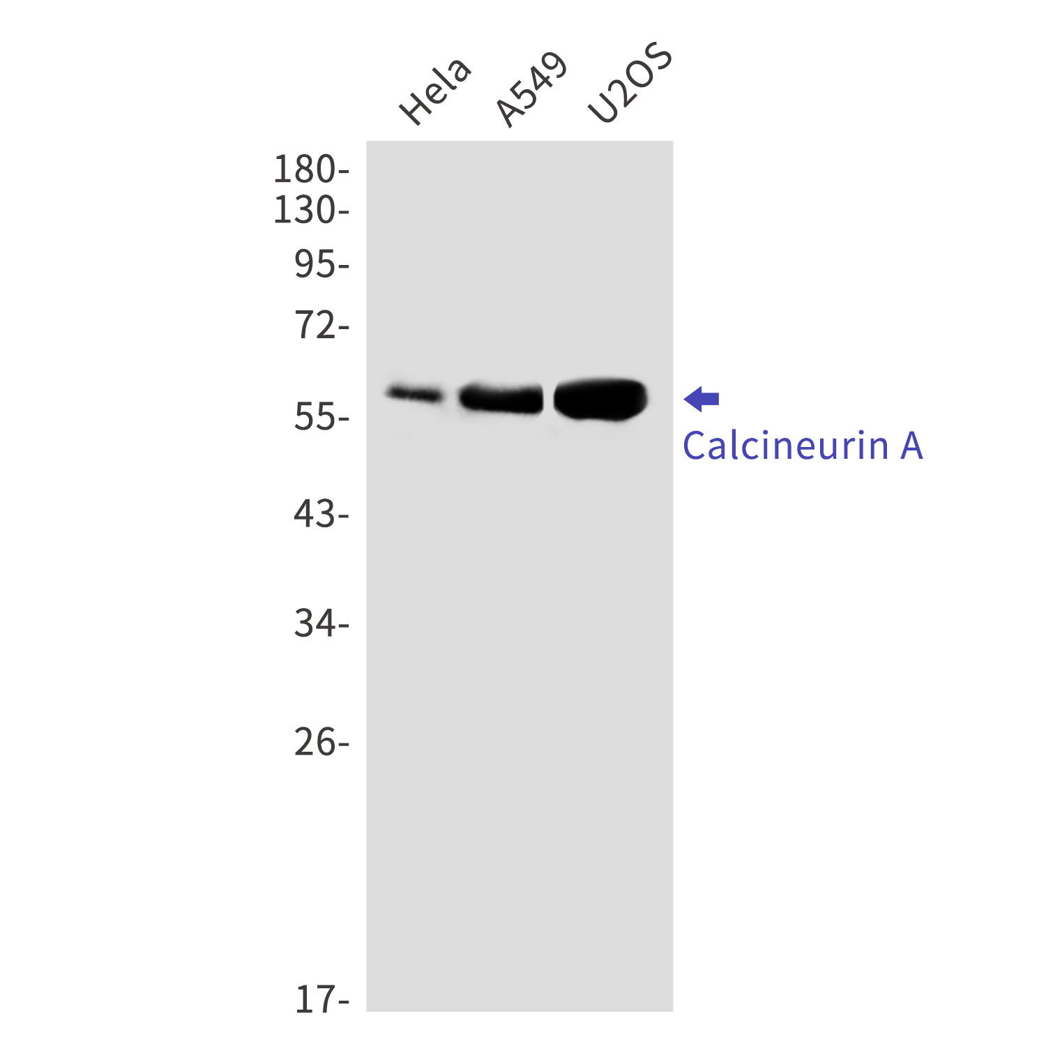 Calcineurin A Rabbit mAb