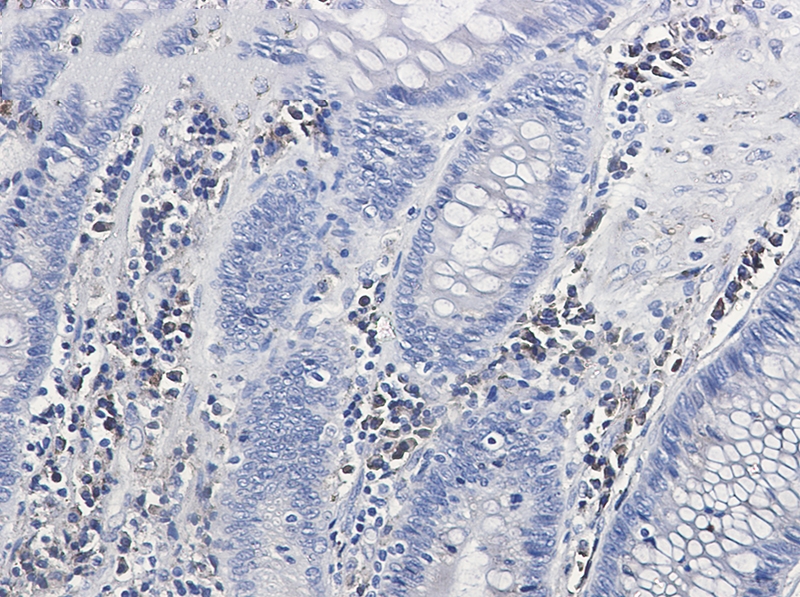 Calumenin Rabbit mAb