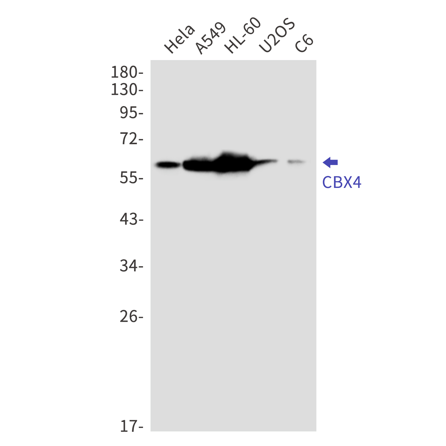 CBX4 Rabbit mAb