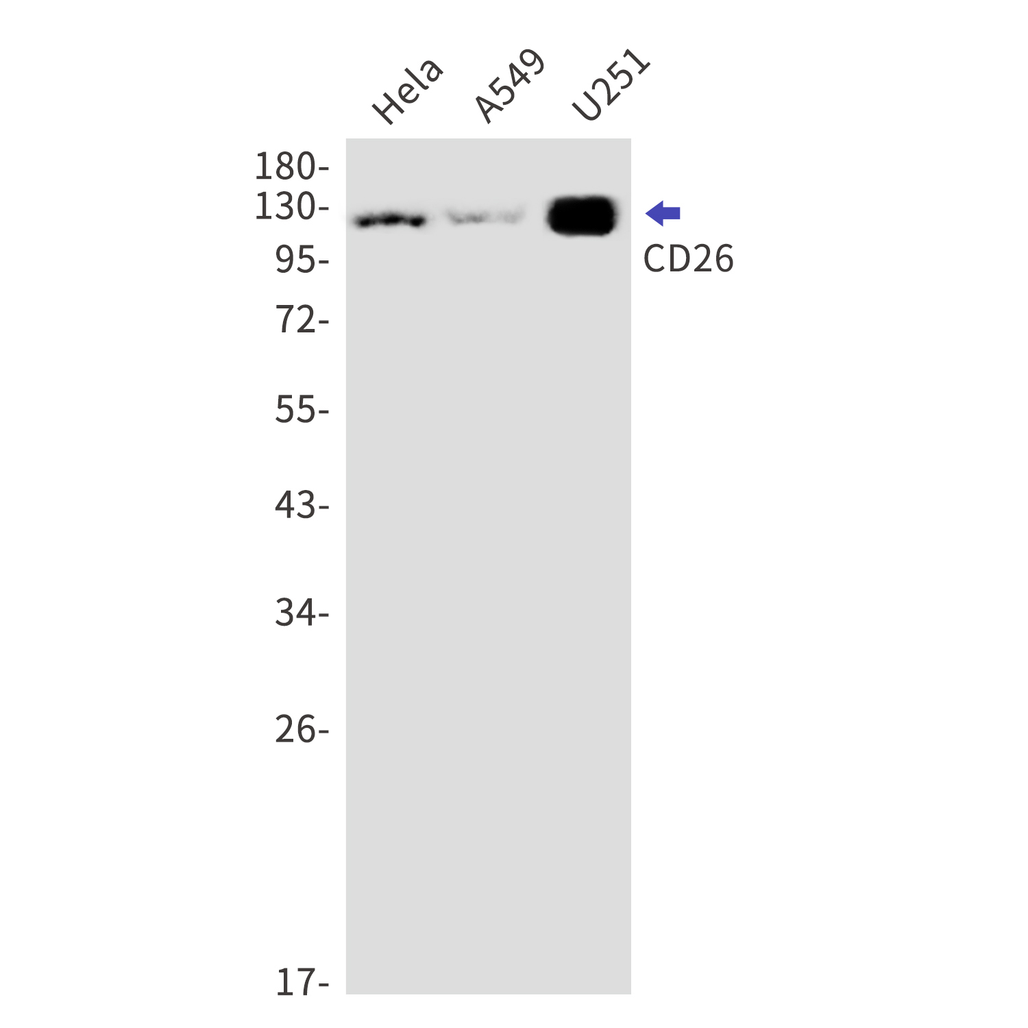 CD26 Rabbit mAb