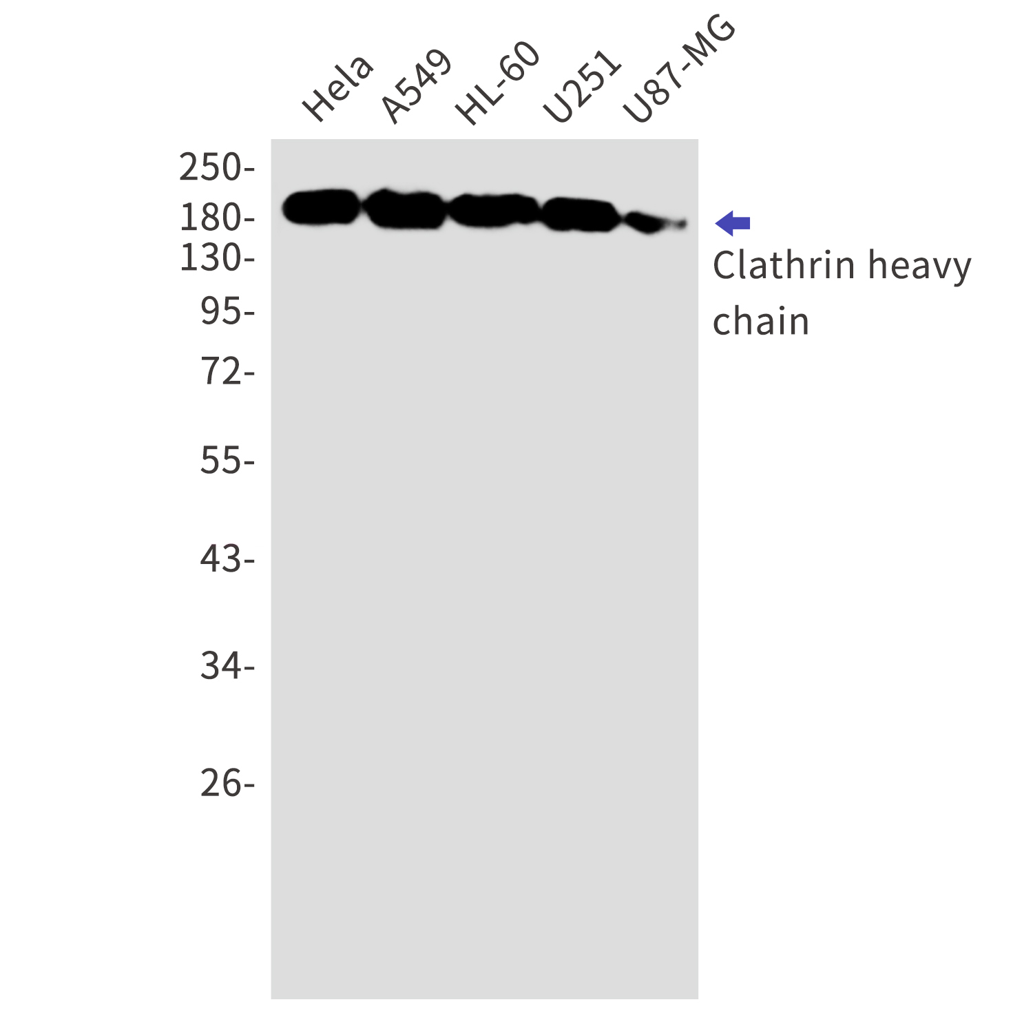 Clathrin Heavy Chain Rabbit mAb