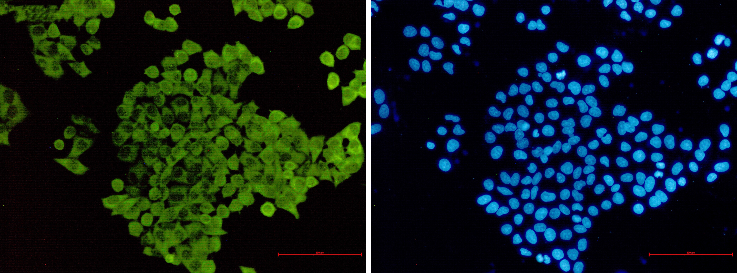 Cofilin Rabbit mAb