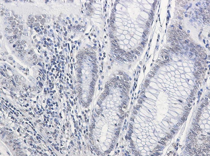 CPS1 Rabbit mAb