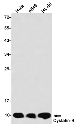 Cystatin B Rabbit mAb