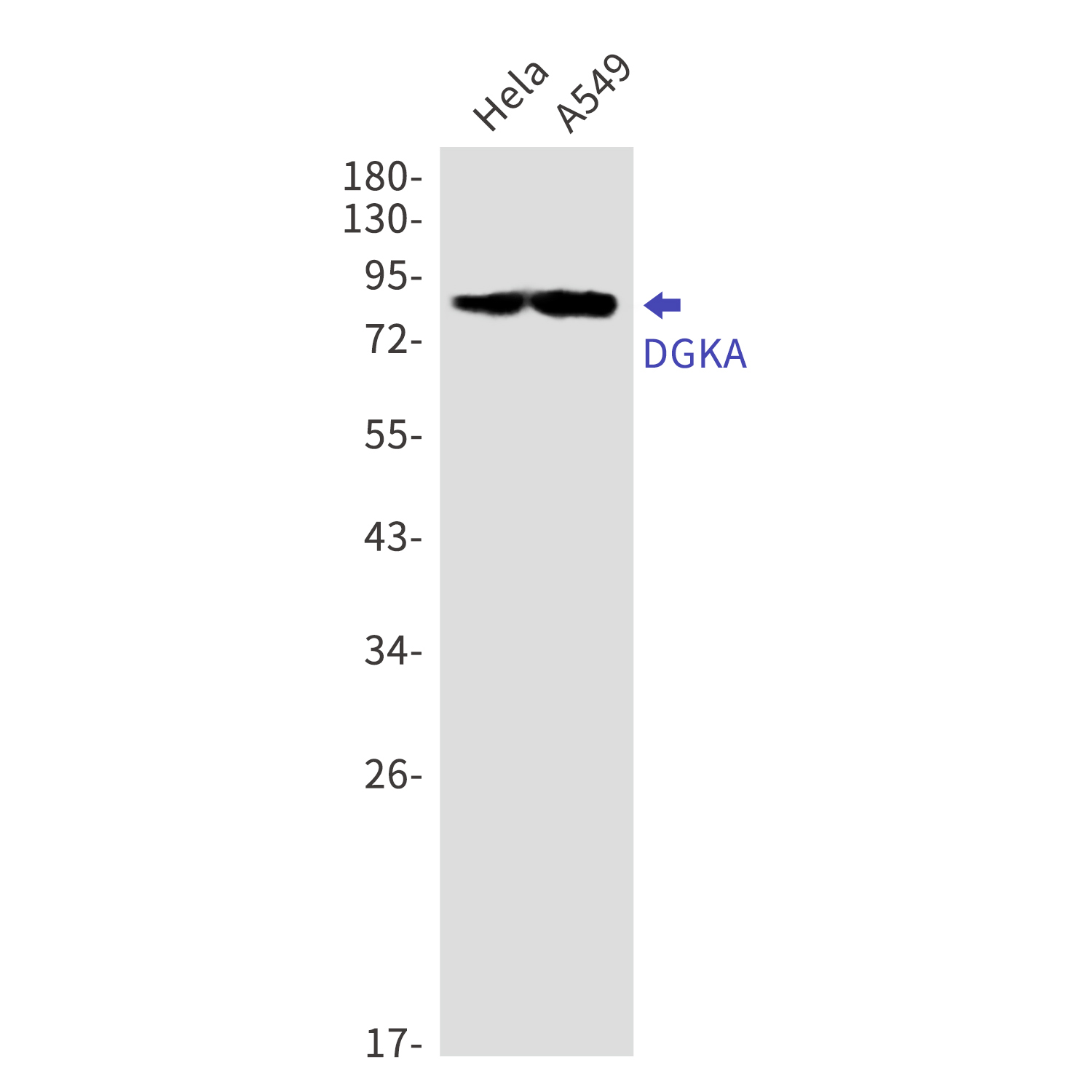 DGKA Rabbit mAb