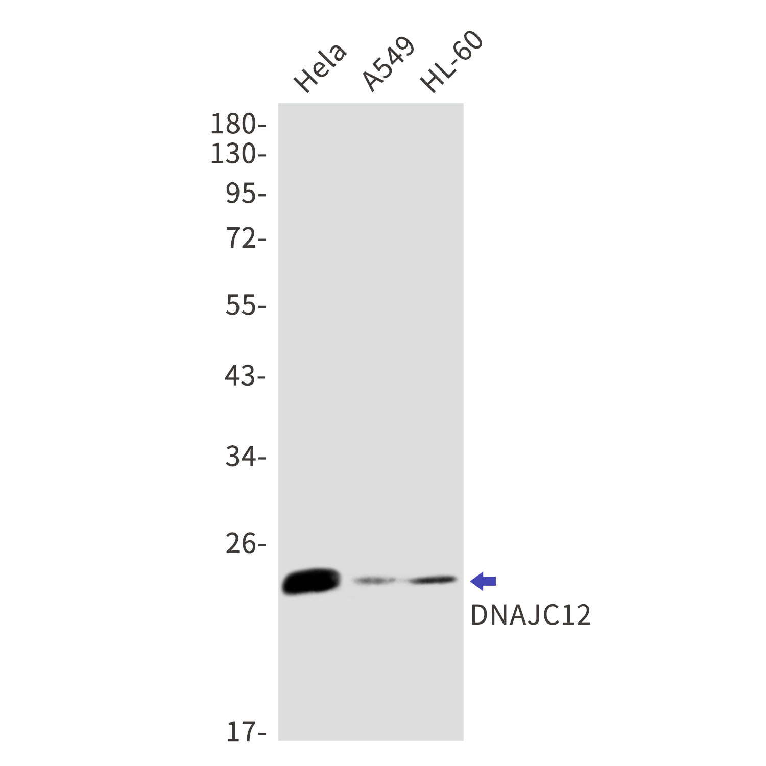 DNAJC12 Rabbit mAb