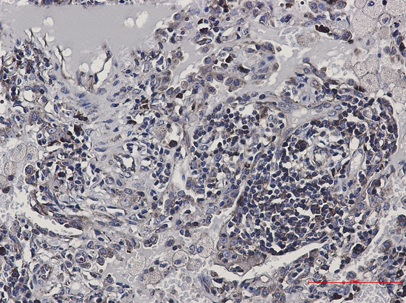 eIF4B Rabbit mAb