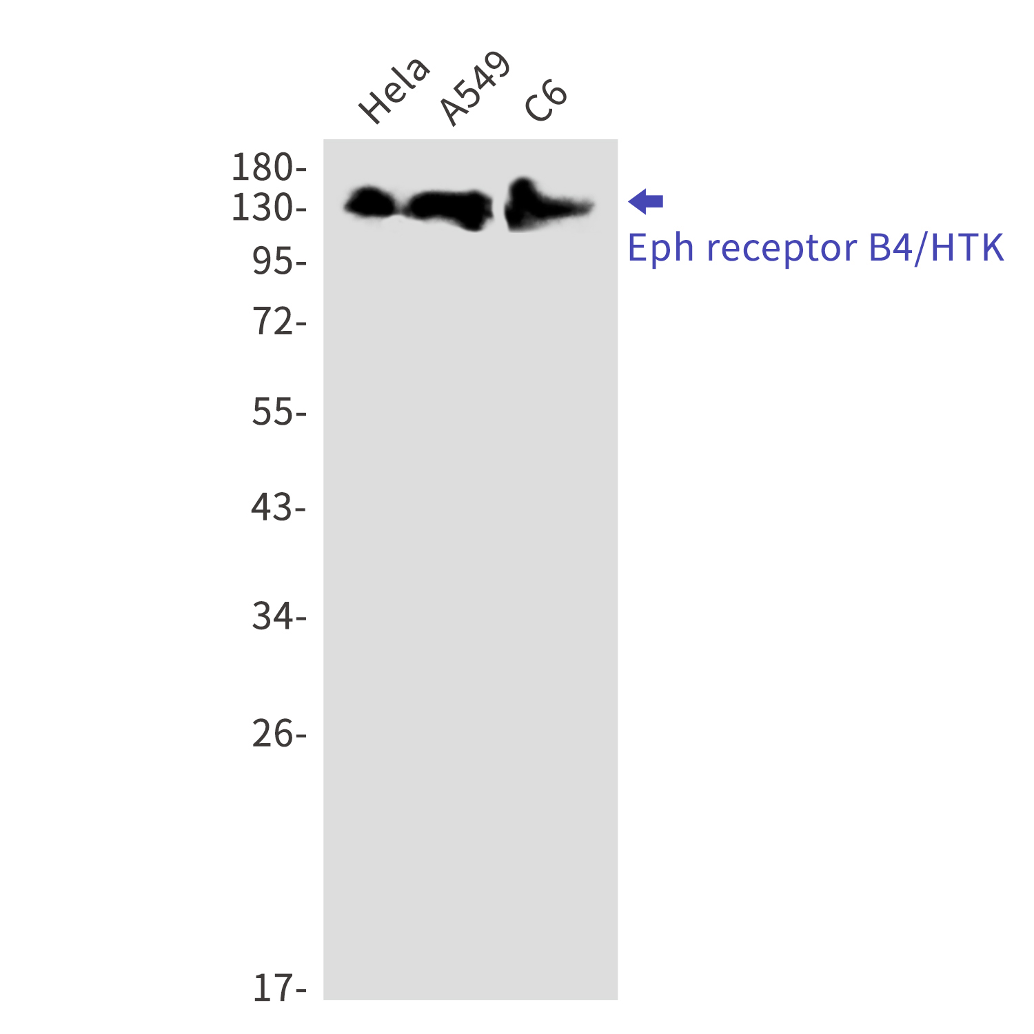 Ephrin Receptor B4 Rabbit mAb