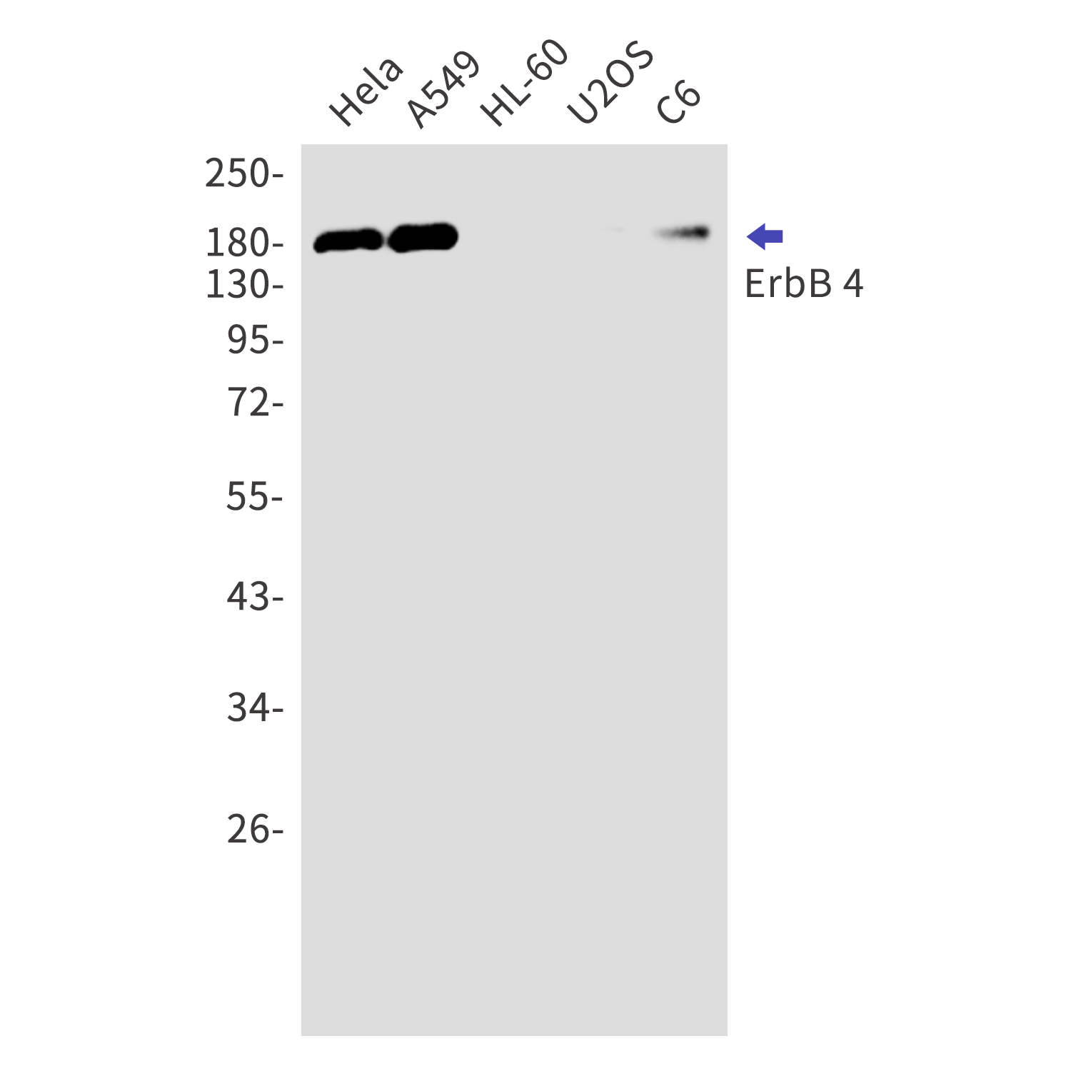 ErbB 4 Rabbit mAb