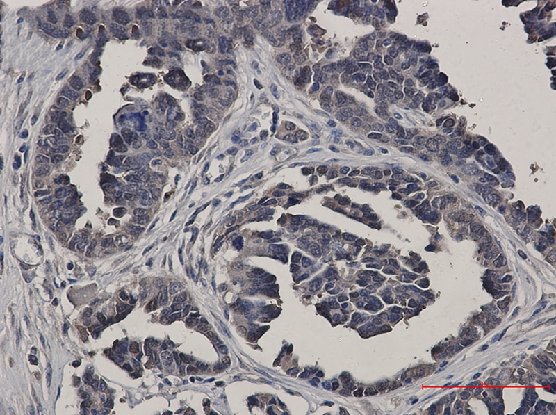 Glutathione Synthetase Rabbit mAb