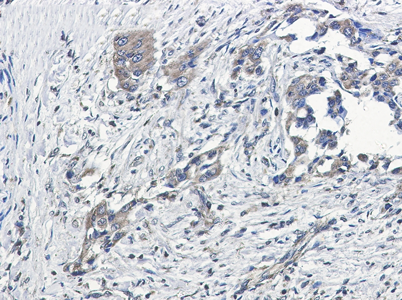 GNAI2 Rabbit mAb