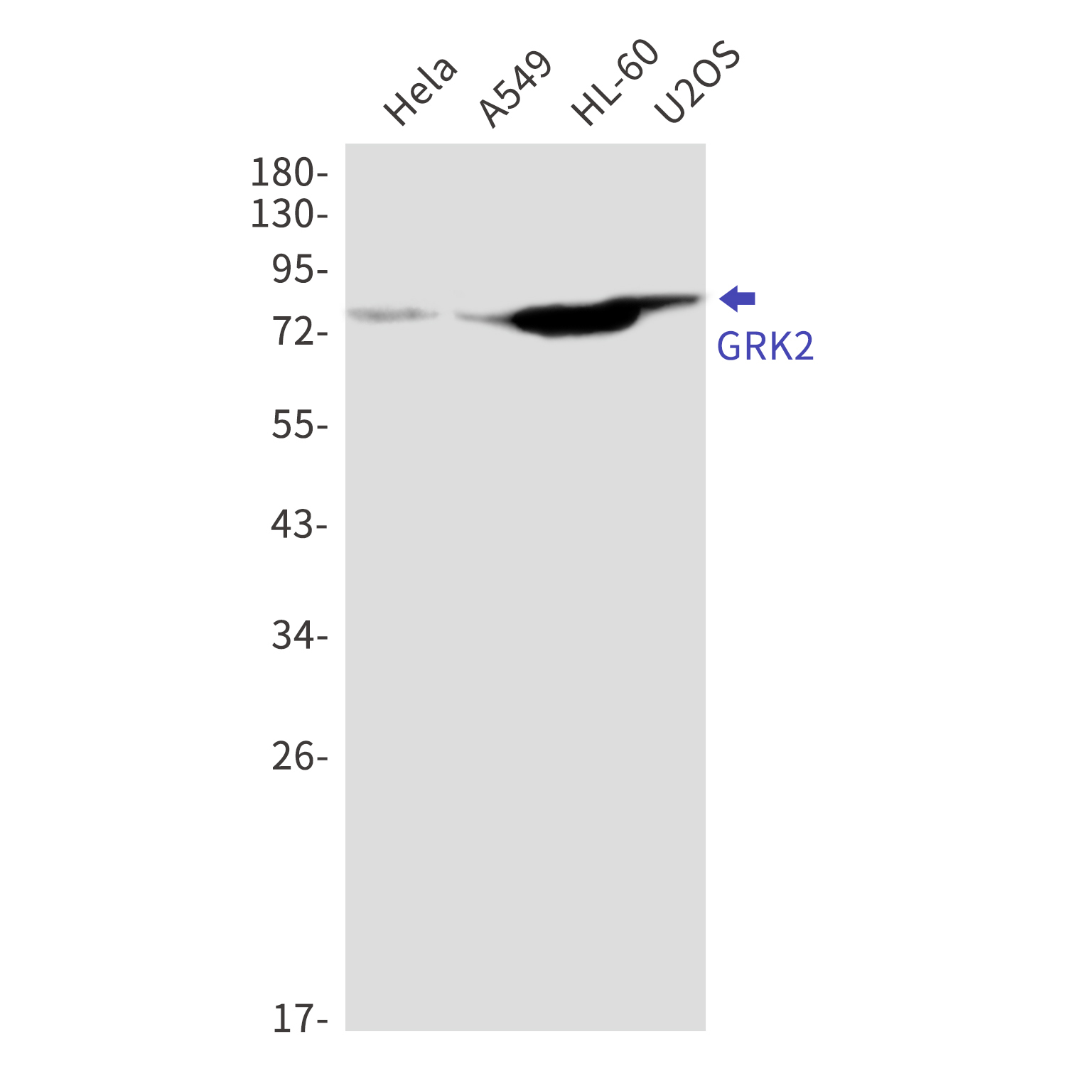 GRK2 Rabbit mAb