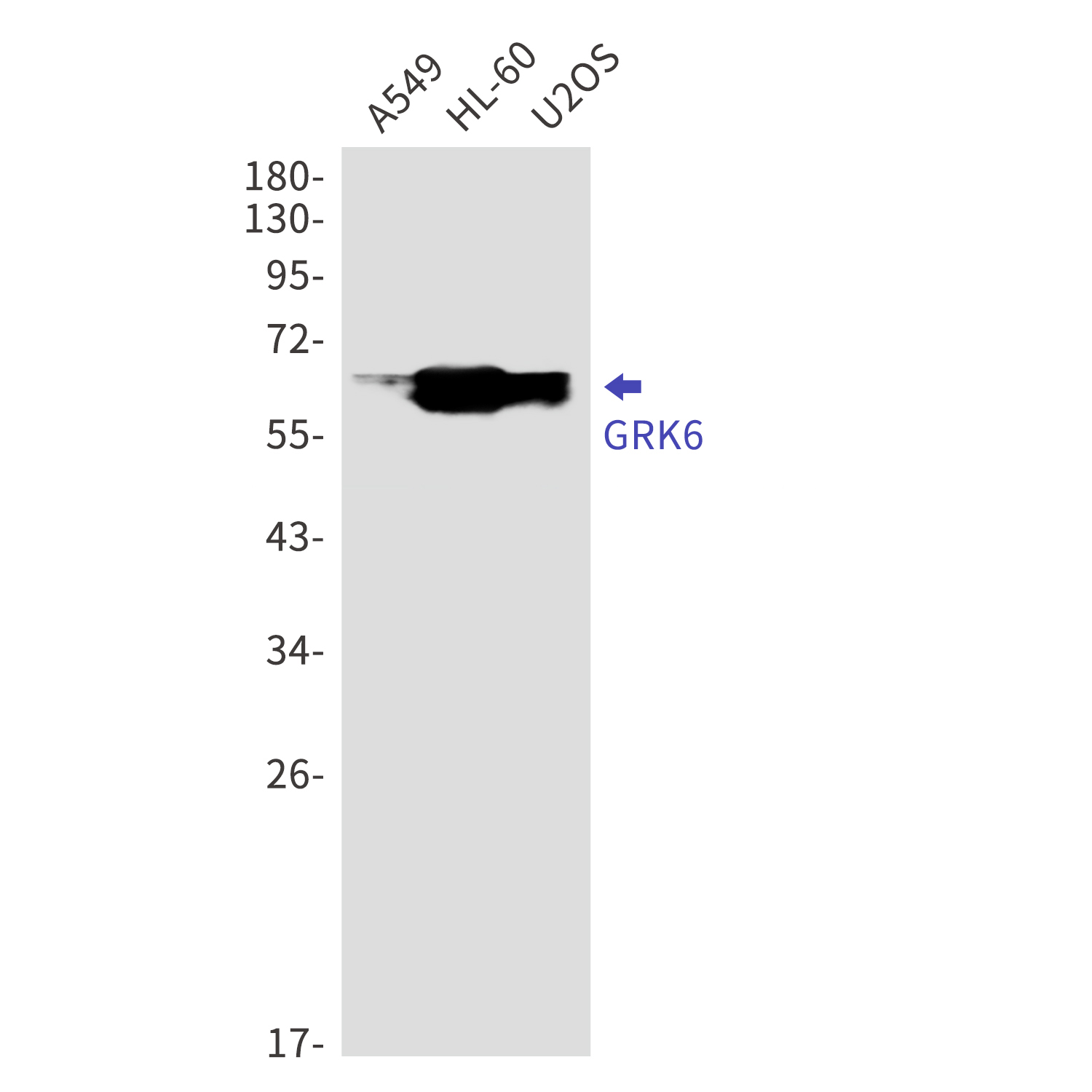 GRK6 Rabbit mAb