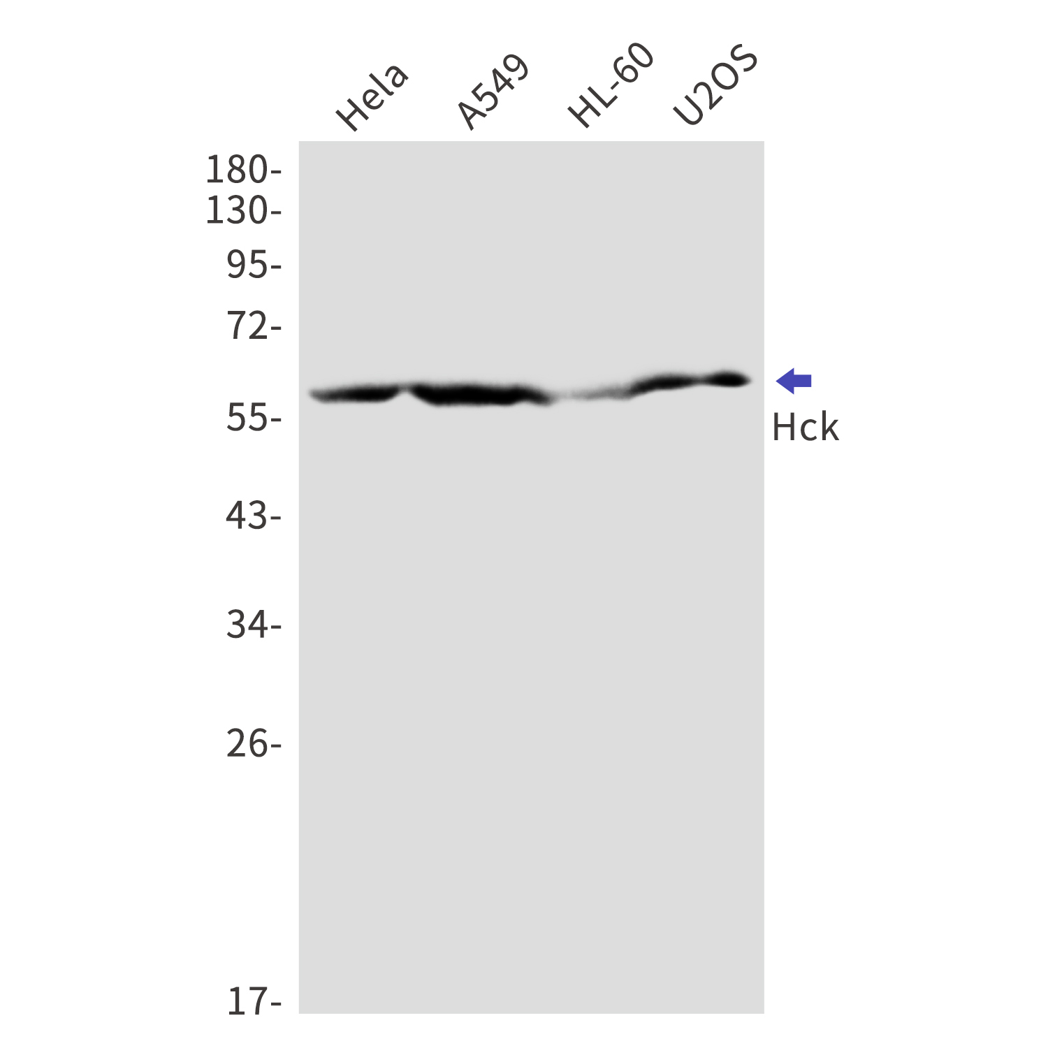 Tyrosine Protein Kinase HCK Rabbit mAb