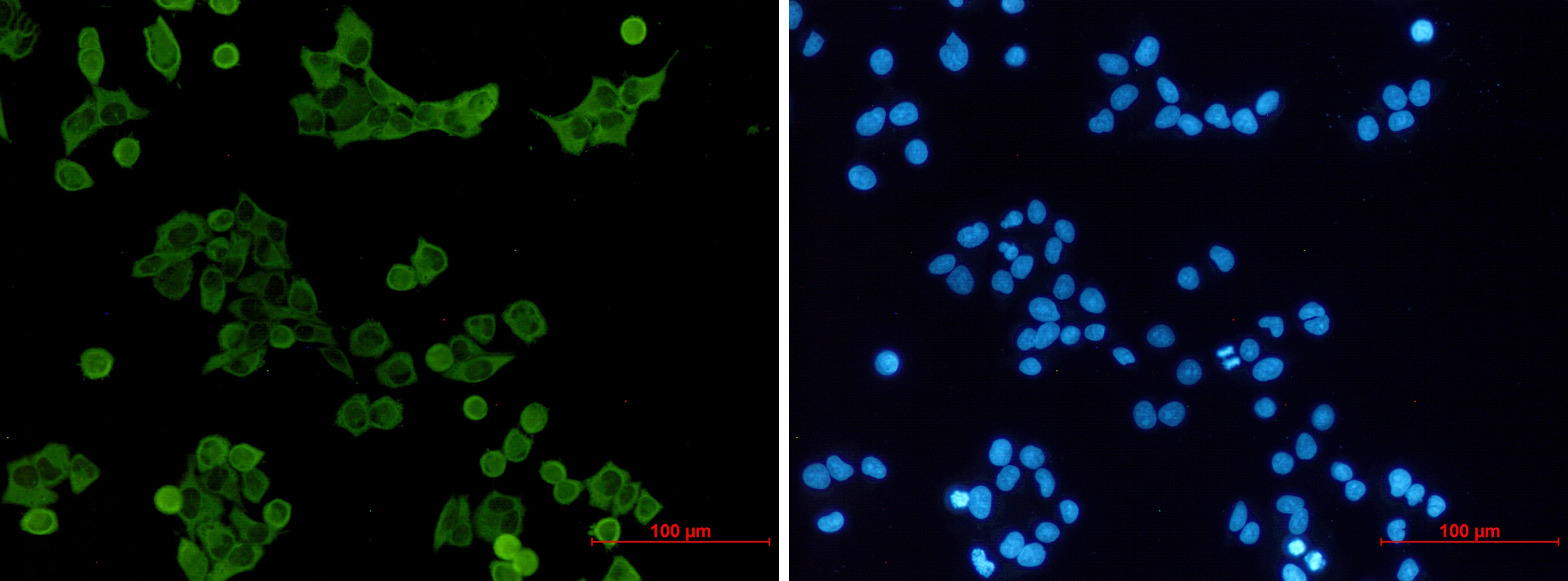 Tyrosine Protein Kinase HCK Rabbit mAb